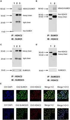 Carbocisteine Improves Histone Deacetylase 2 Deacetylation Activity via Regulating Sumoylation of Histone Deacetylase 2 in Human Tracheobronchial Epithelial Cells